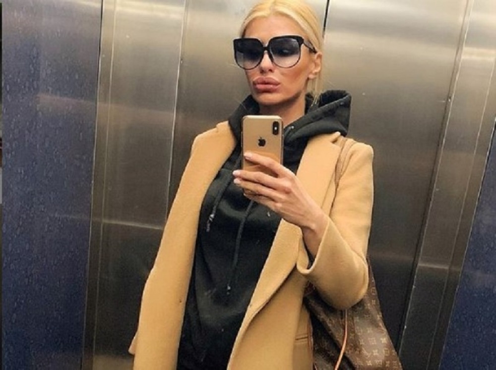 Oglasila se Sandra Obradović iz bolnice:"Razvalio mi je nos, uzeo dete na silu!"