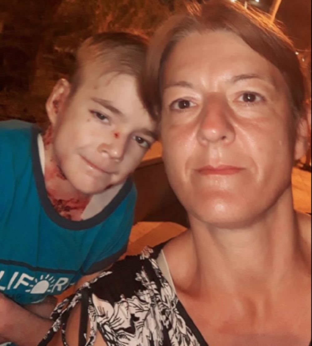 U rukama sam držala bebu u ranama, tad je počela borba! Ispovest posle smrti malog Despota koja para dušu