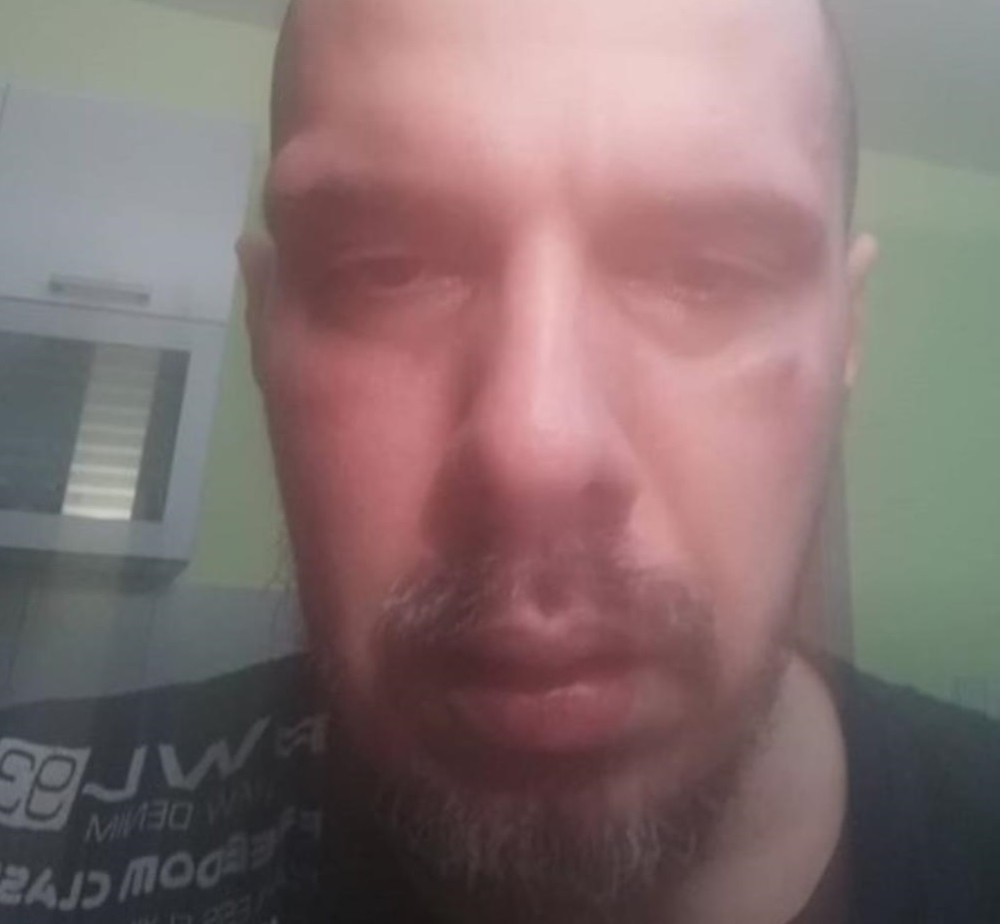 Bojan Tomović pretučen nakon što je potvrdio da je otac Miljaninog deteta! Oni su osumnjičeni!