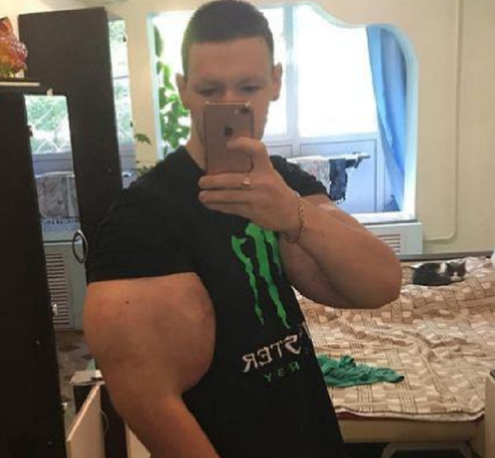 Ruski "Popaj" debitovao u MMA, a onda saznao da može ostati bez ruku! (VIDEO)