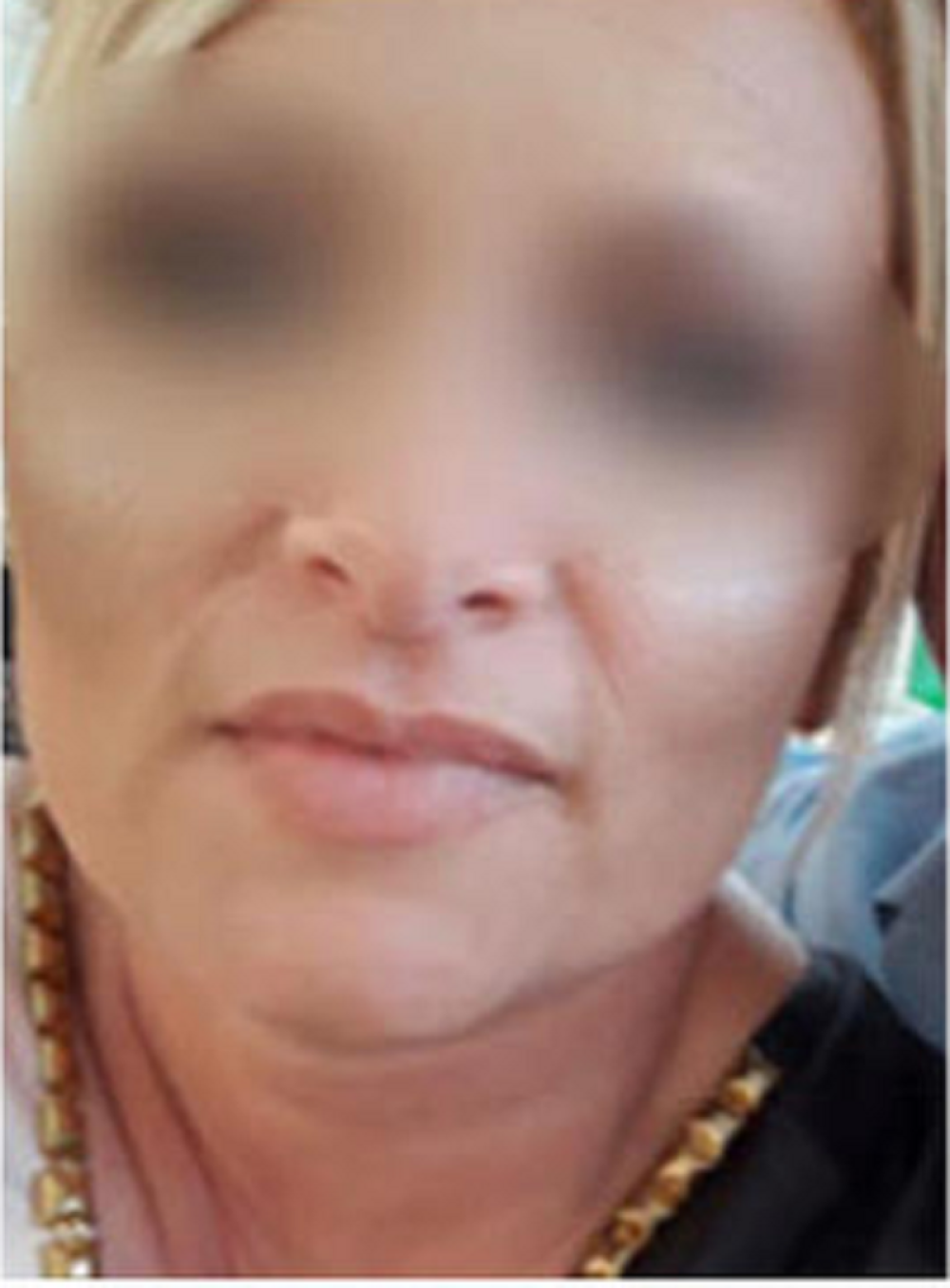 Gordana se oporavlja, a poznata je i sudbina napadača!