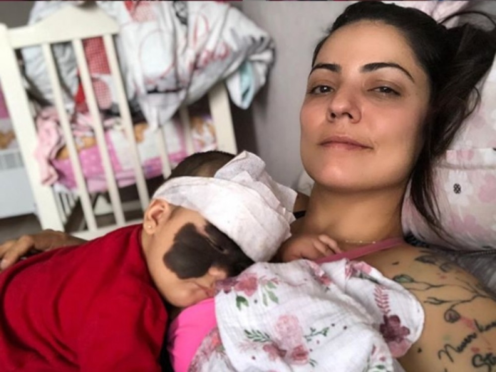 Roditelji ove devojčice preživljavaju pravi horor zbog izgleda svoje ćerkice! Nakon ovoga njen život više neće biti isti!