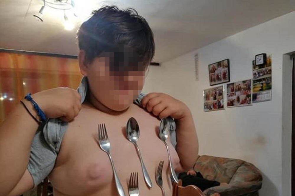 Luku iz Ždreča prozvali Božjim čudom! Metal se lepi za njega, doktori nemaju nikakvo objašnjenje! (FOTO)