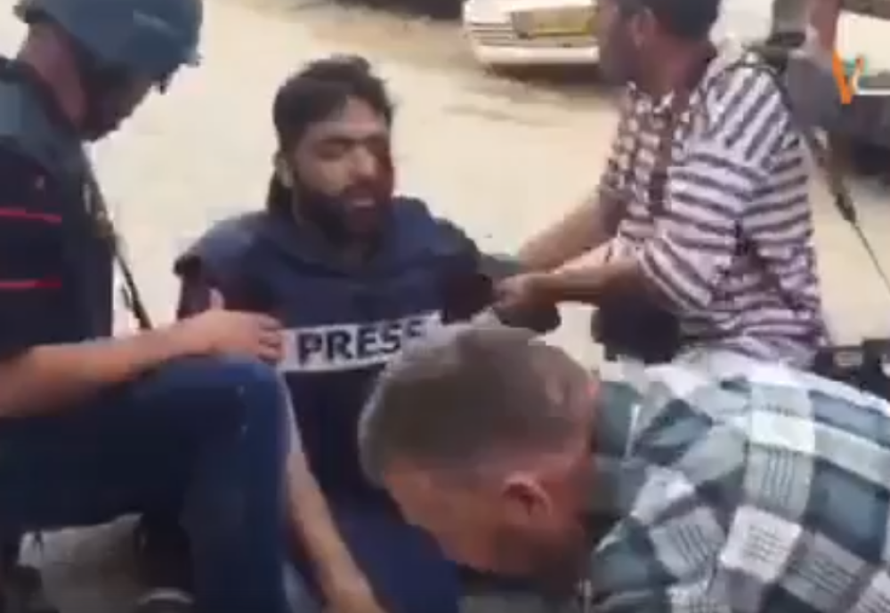 Novinar izgubio oko! (VIDEO)