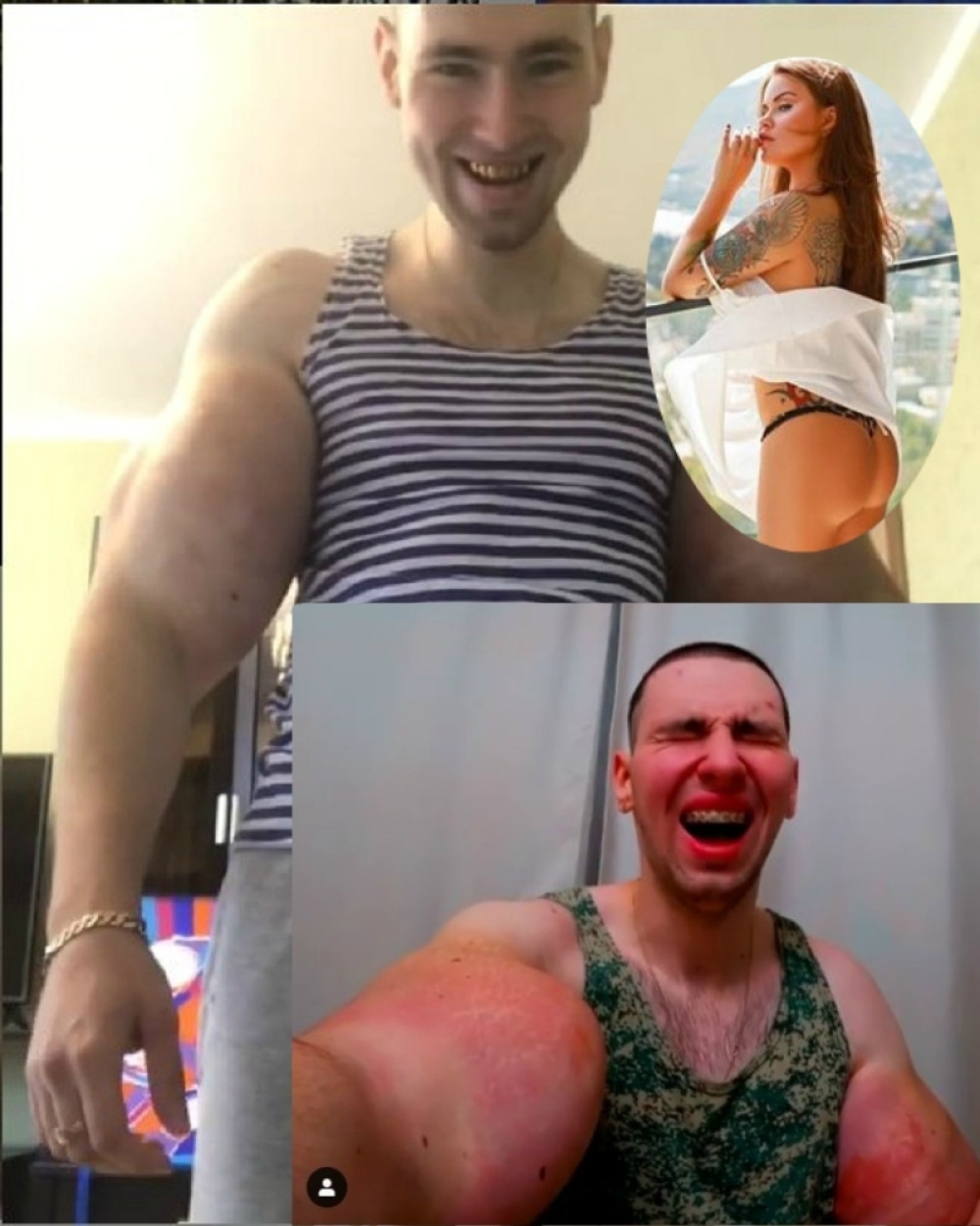 Verenica ga nagovorila na opasnu operaciju zbog koje je umalo izgubio obe ruke, a onda ga ostavila! Mukama nije kraj pošto je dobio batine od dvostruko starijeg čoveka! (FOTO/VIDEO)