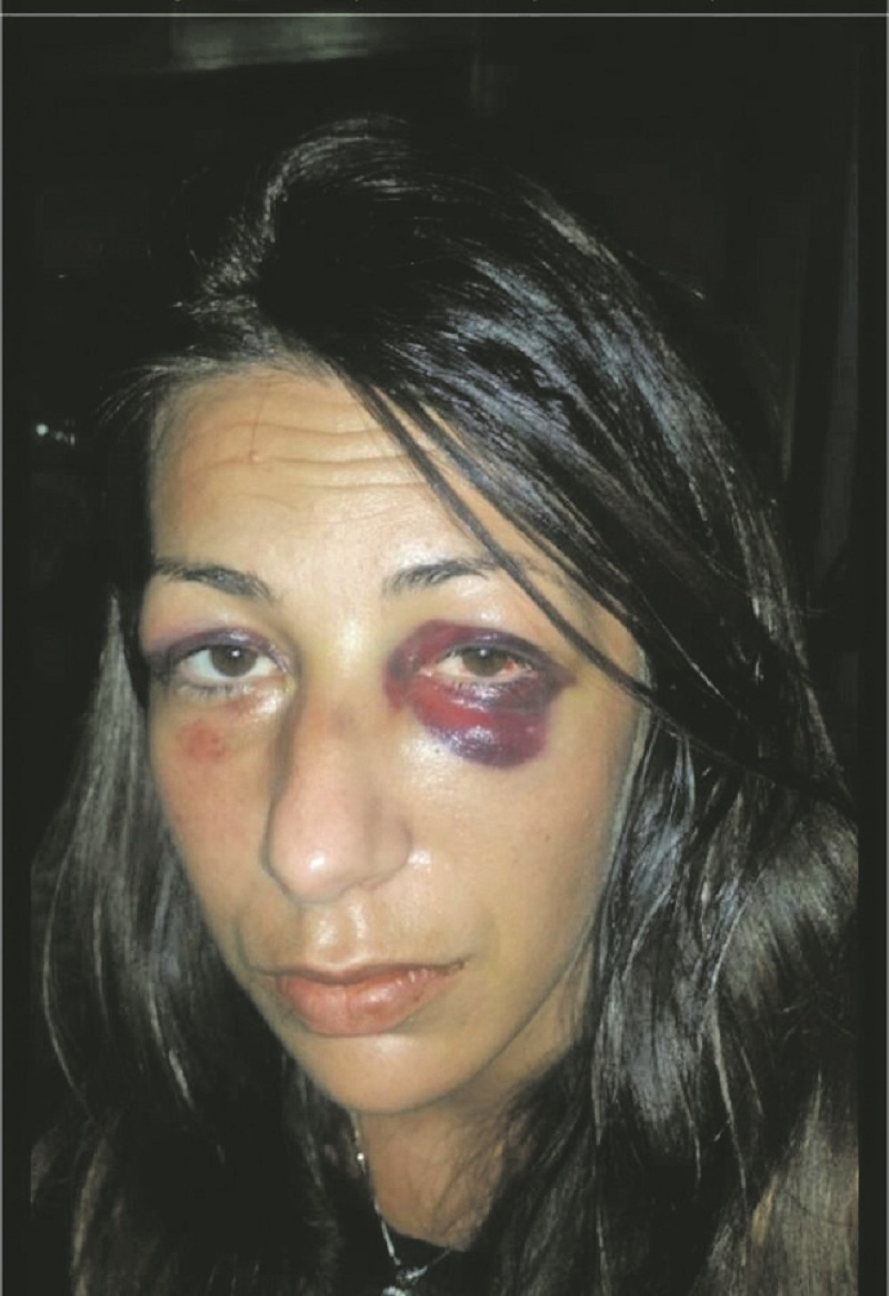 Žrtva porodičnog nasilja progovorila o onome o čemu drugi uporno ćute! Dobro pročitajte Bojanin apel