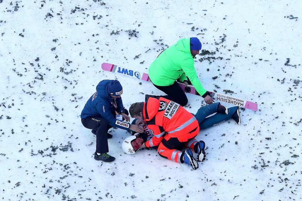Čuveni ski-skakač doživeo nezgodu prilikom pada, publika u šoku gledala krvavu scenu na snegu (VIDEO)