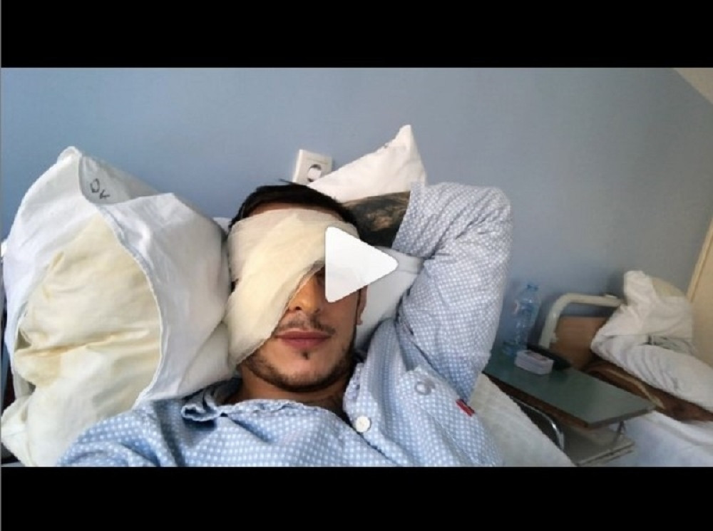 Emotivno obraćanje našeg MMA borca, prestoji mu najveća borba života da sačuva vid! (FOTO/VIDEO)