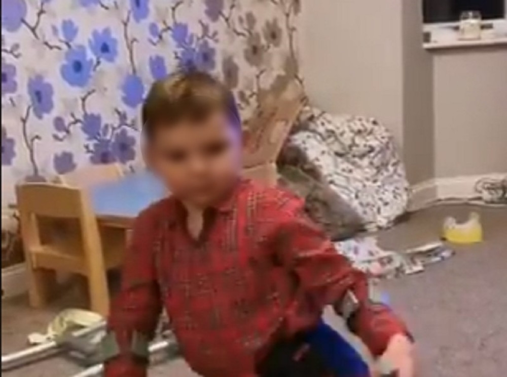 Roditelji teško zlostavljali dečaka (5). Amputirane mu obe noge (FOTO/VIDEO)