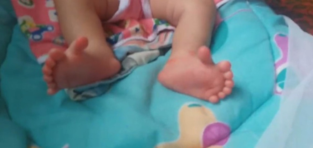 Silovana beba preminula u bolnici