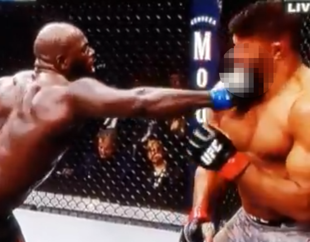 Udarac je bio toliko jak da mu je sasvim rascepao kožu i unakazio ga doživotno! Ima nove centimetre osmeha! Krvavo i strašno (VIDEO)