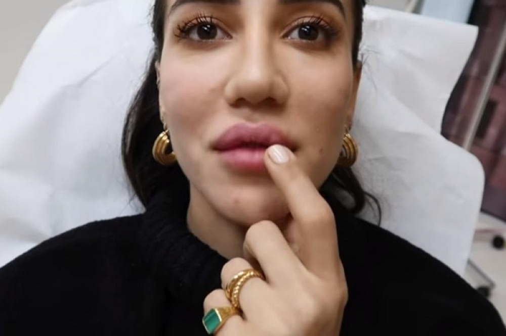 Poznata Srpkinja podelila snimak na kom krvari dok joj smanjuju usne