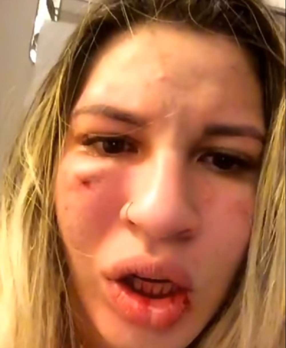 Žena golmana jedva izvukla živu glavu, posle zveskih batina zaključana u kupatilu sačekala spas (VIDEO)