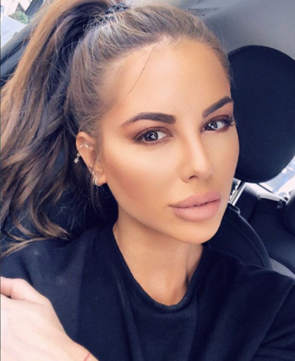 Zorannah progovorila nakon operacije i negativnih komentara! (FOTO/VIDEO)