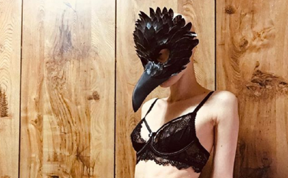 Ima genetski poremećaj, slepa je i ćelava, a jedan je od najplaćenijih modela u čitavom svetu! (FOTO)