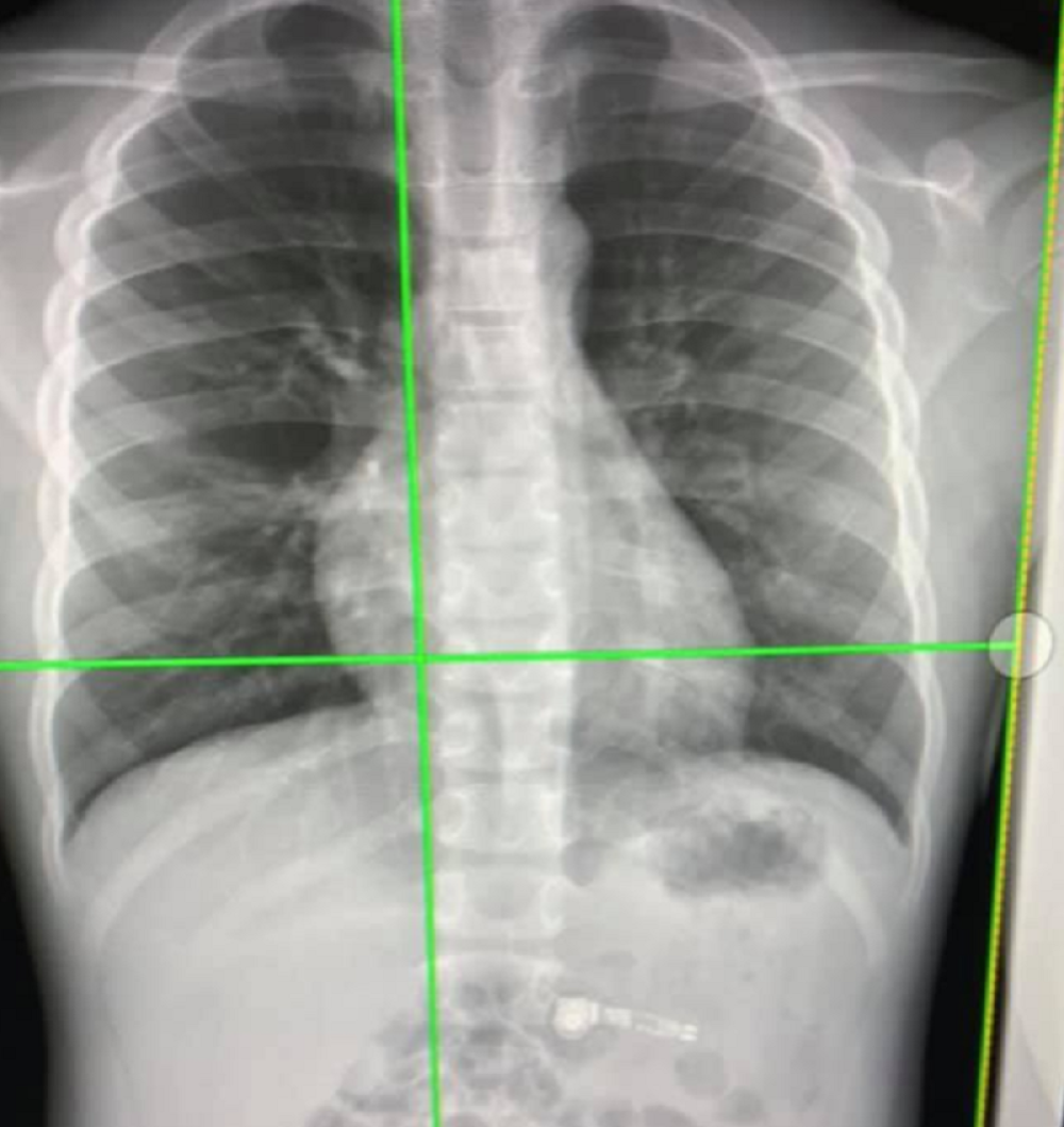 Kada su doktori uradili rendgen, nisu mogli da poveruju šta je progutao! (FOTO)