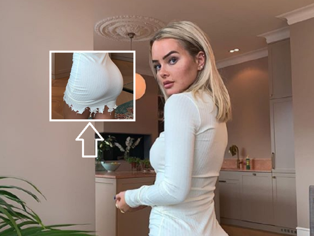 Sofija za "bagatelu" korigovala zadnjicu! Nakon operacije, rezultat je porazio!