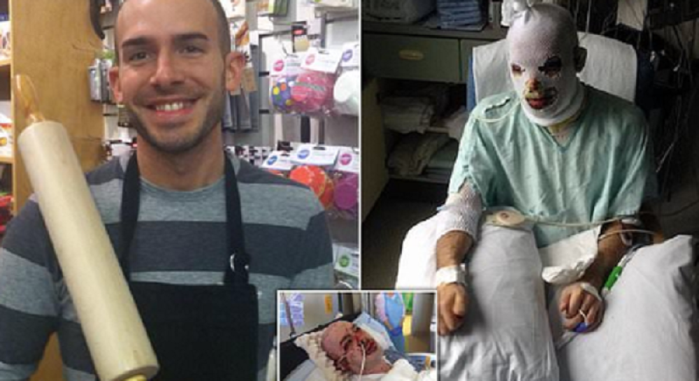 Zašili mu oči, a on se ogulio unutar i izvan tela, muškarac prošao pakao nakon saznanja da je teško bolestan