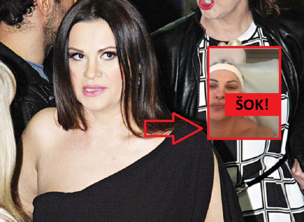 Jana bez trunke šminke na korekciji! Kada vidite fotografije pevačice, neće vam biti dobro! (ŠOK FOTO)