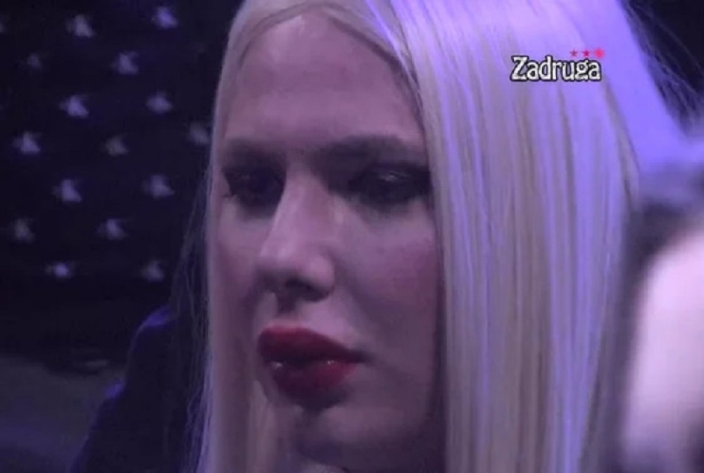 Brendon ubrizgavao svakave gluposti u obraze i usta, pa morao da snosi posledice, a evo i kakve: Malo je reći fuj! (VIDEO)