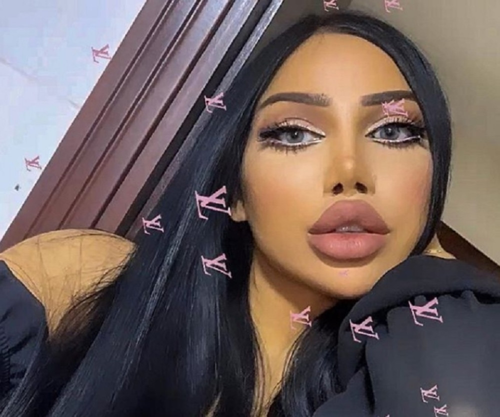 Brac lutka joj bila uzor? Hirurg je pravio kreciju, a njena pojava izaziva burne reakcije na društvenim mrežama (FOTO)