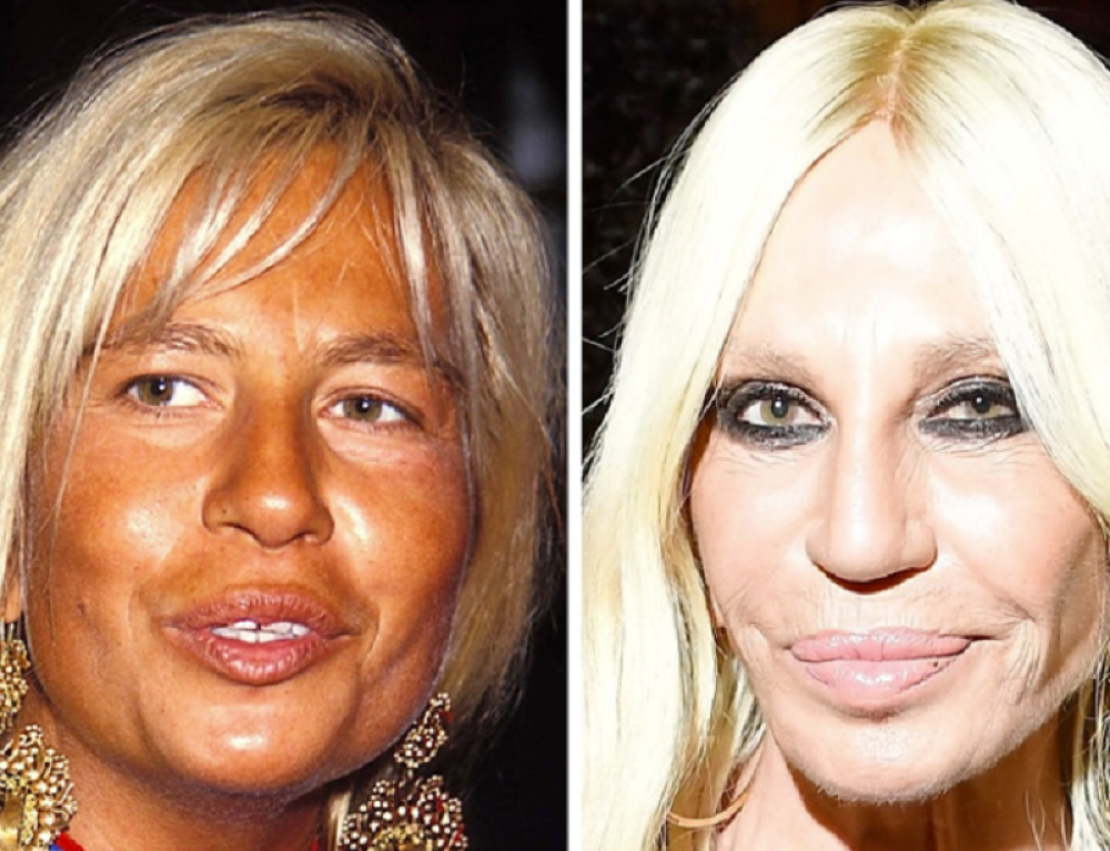 Bila je zavisnica od kokaina, brata su joj ubili, a sebe je uništila plastičnim operacijama: Iskrena životna ispovest Donatele Versaće! (VIDEO)