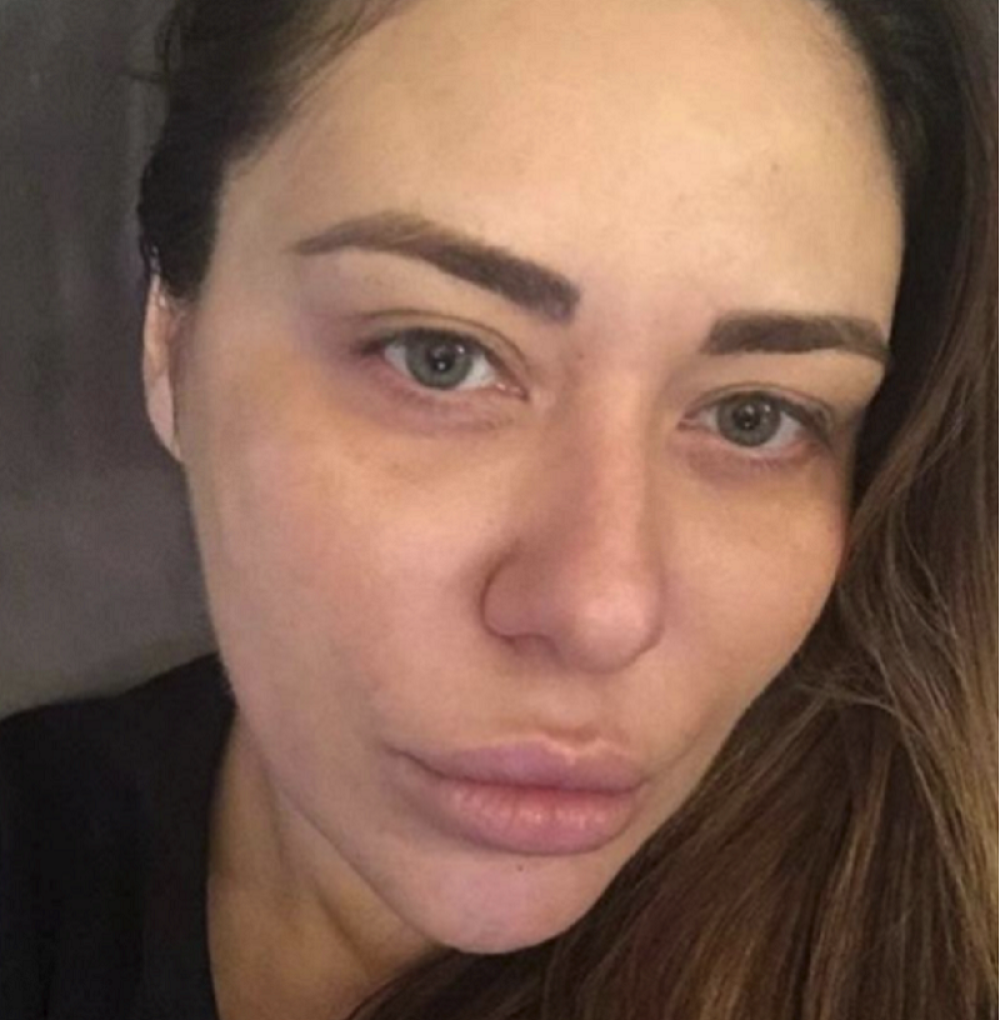 Ana Nikolić završila u bolnici zbog alkohola! Zbog smanjenja želuca ne sme da pije! Svi detalji!