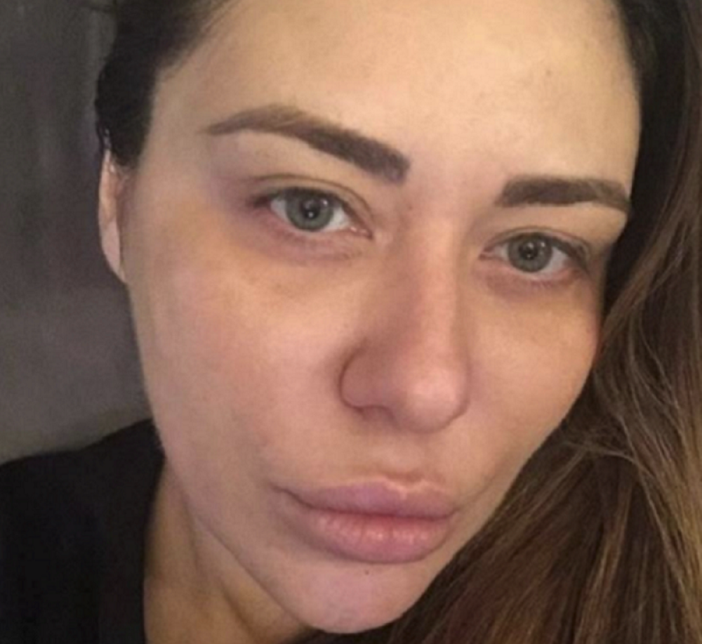 Ana Nikolić kolabirala! Pevačica hitno prevezena u bolnicu!