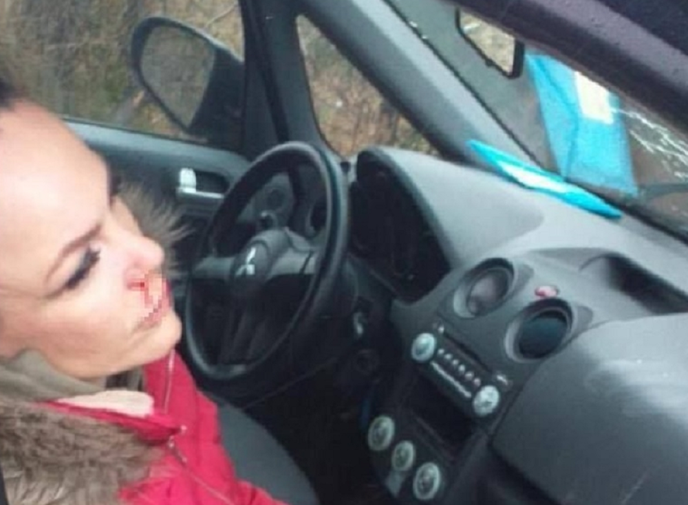 Slađa Petrušić doživela saobraćajnu nesreću: Krv i staklo na sve strane (FOTO)