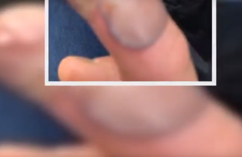 Nesrećna žena završila na operacionom stolu zbog odvratne navike! (FOTO/VIDEO)