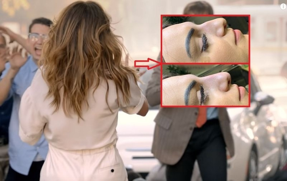 Plastični hirurg osramotio zvezde - objavio fotke poznatih dama pre operacija! (FOTO)