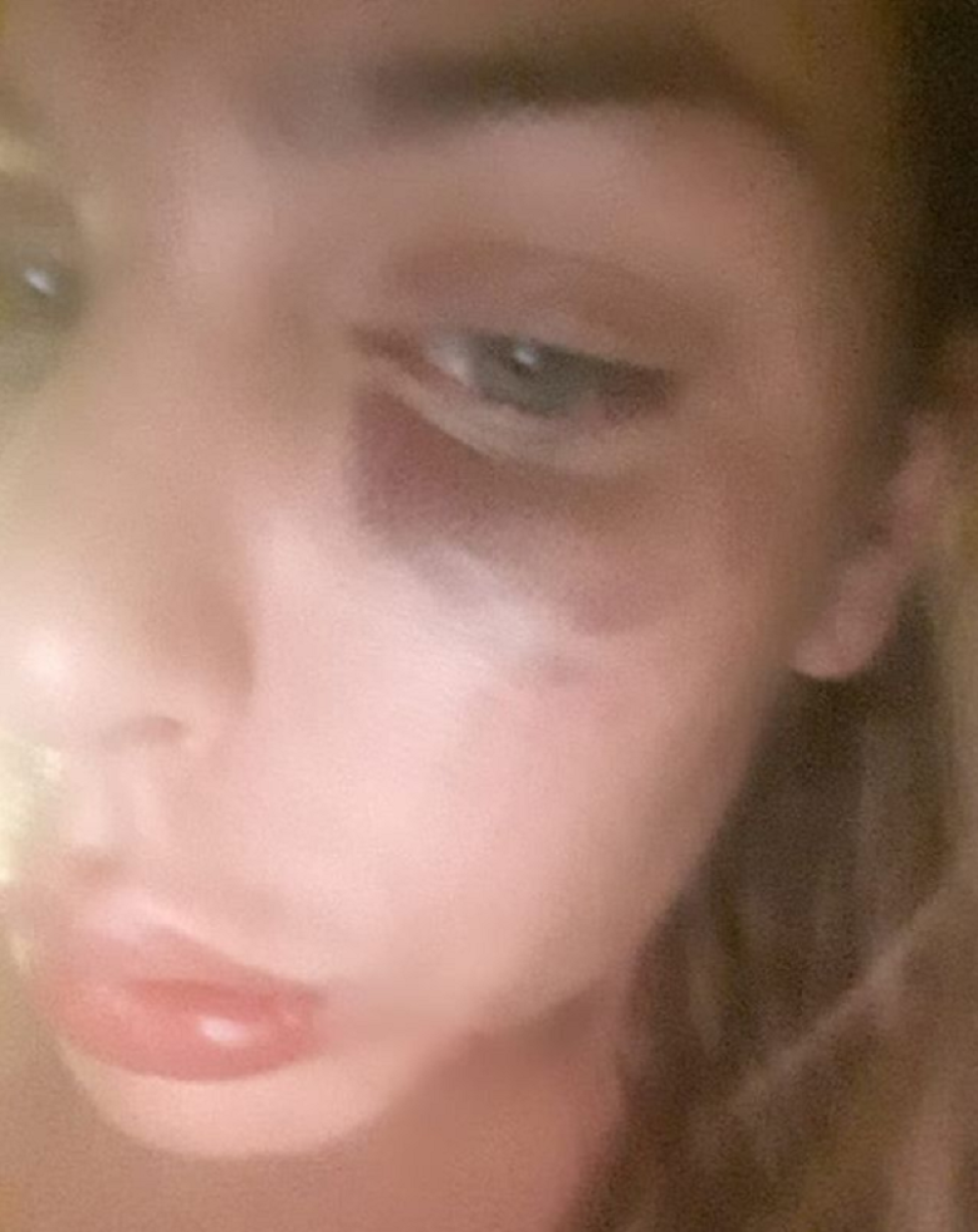 Dan posle vesti da je pretučena oglasila se Ava Karabatić: "Koliko ti je platio da smanjiš medijsku bruku i navedeš glupi razlog?"