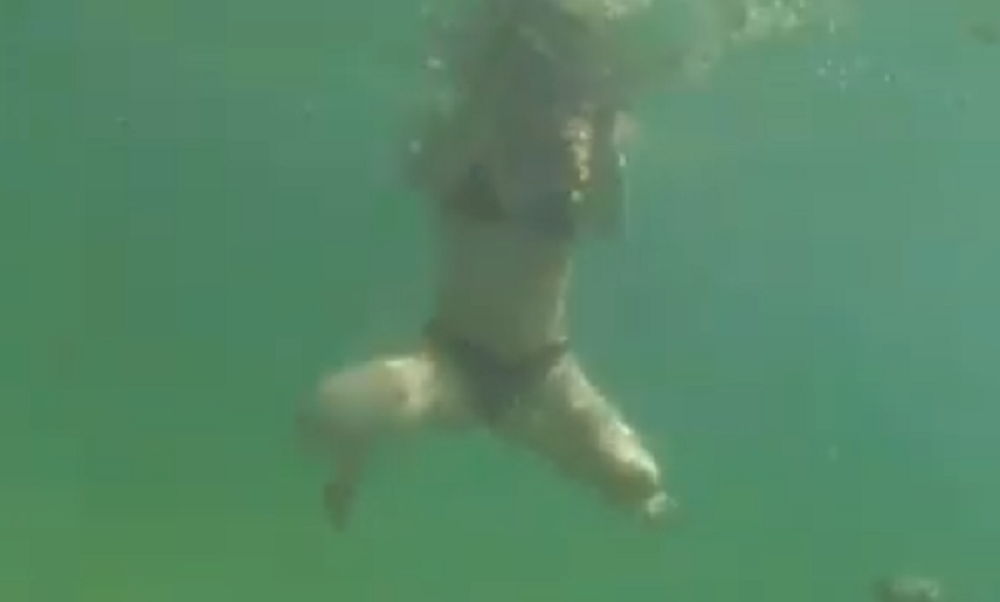 Ni slutila nije da će početi da joj kidaju kožu i meso! (VIDEO)