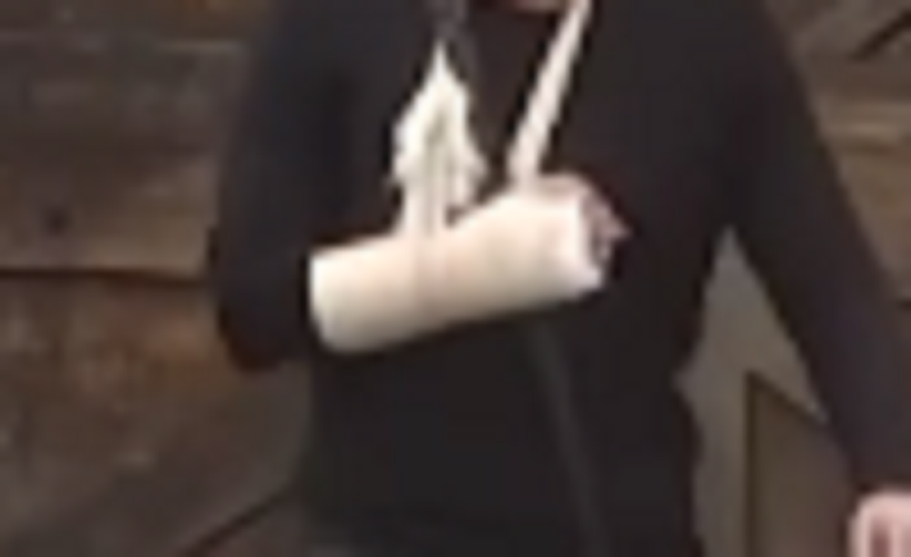 Zadrugar slomio ruku na dva mesta, zakazana operacija! (VIDEO)