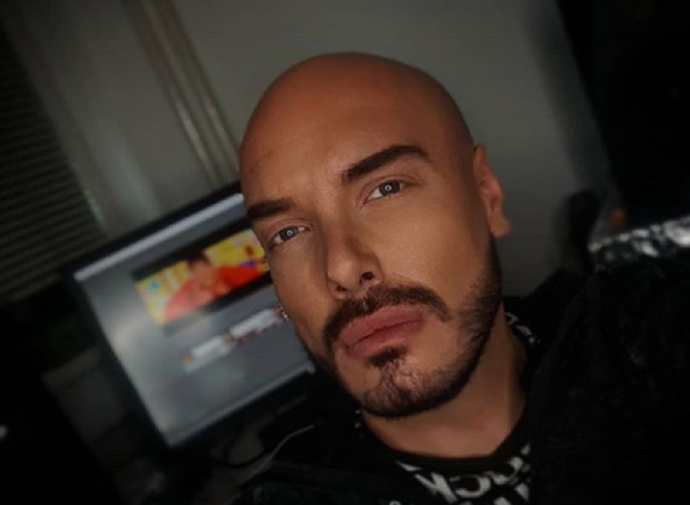 Estetske korekcije izmenile lični opis Mirku Gavriću? Pogledajte kako izgleda njegovo netaknuto lice! (FOTO)