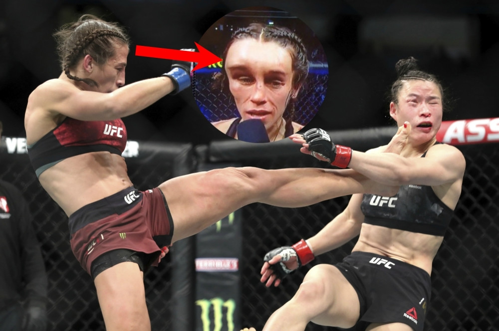 Kad žene krenu da se "šminkaju" - slavna fajterka neprepoznatljiva zbog batina, obe završile u bolnici (FOTO/VIDEO)