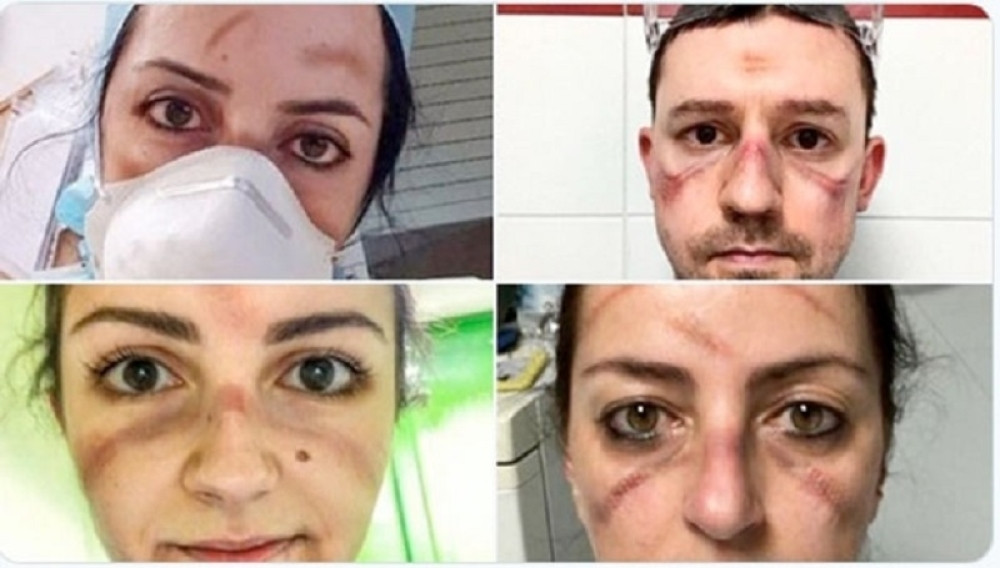 Pogledajte herojska lica italijanskih medicinara (VIDEO)