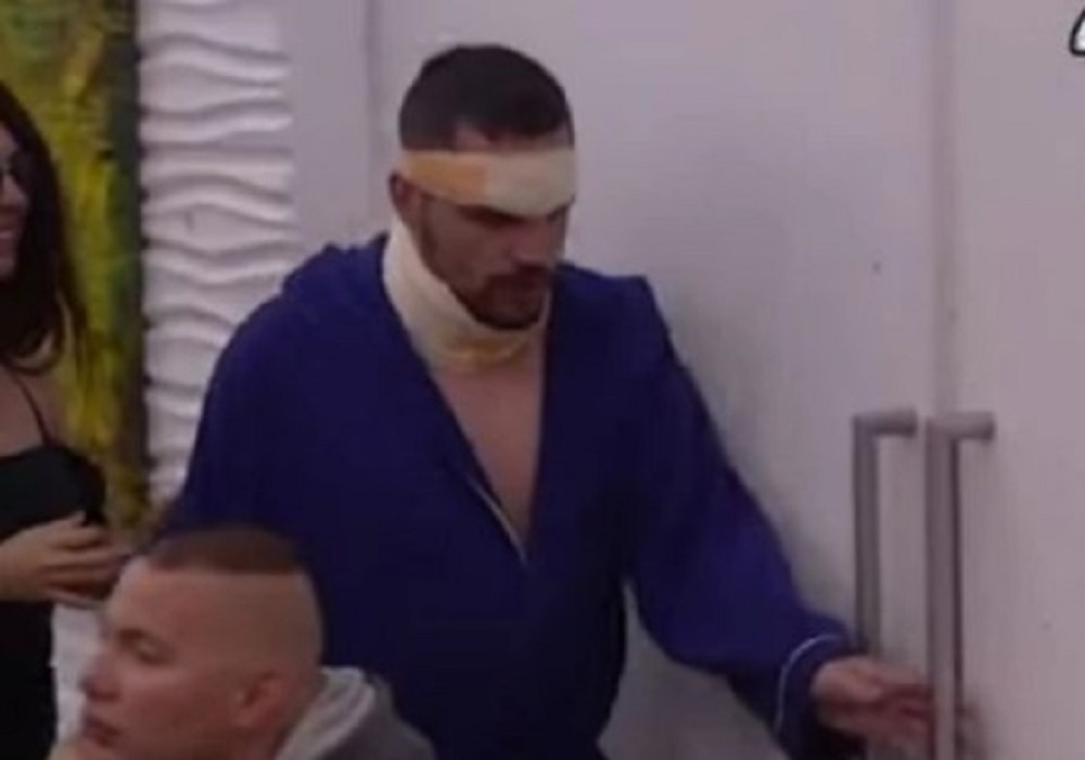 Bane Čolak unakažen nakon što ga je Mensur pretukao "7 kompči imam na glavi"