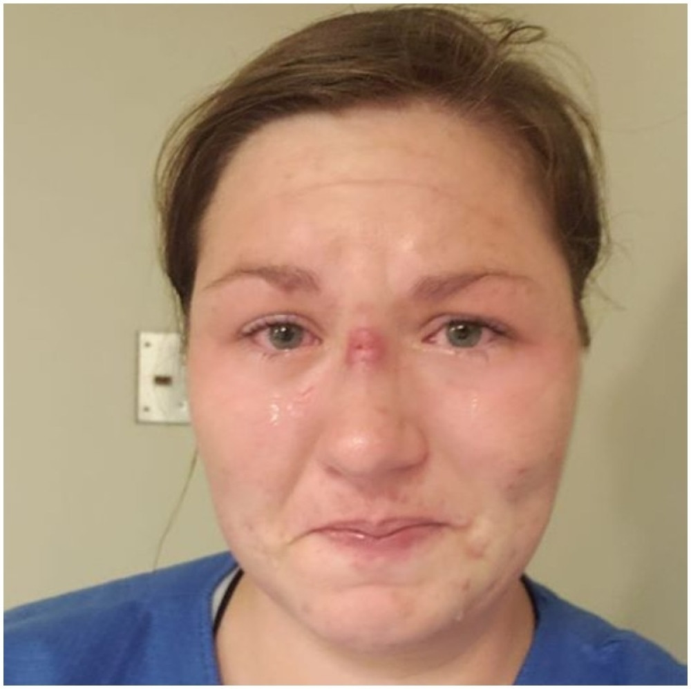 Ispovest medicinske sestre: "Najgore je kad čujem kako preminulima zvone mobilni"