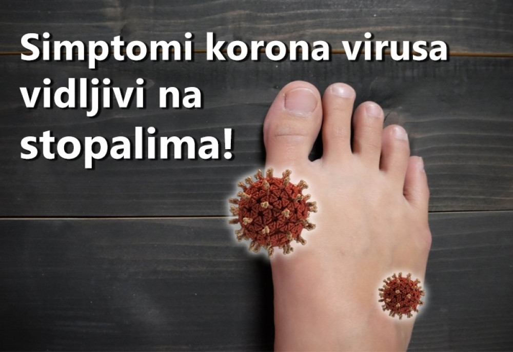 Liči na ujed pauka, ali bi mogao da bude vrlo opasan