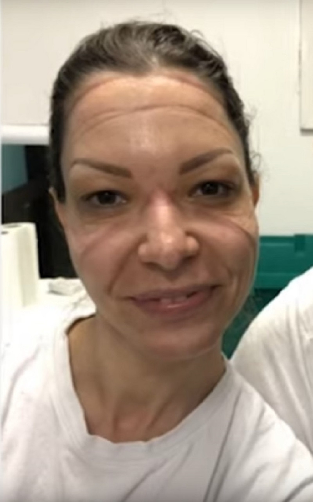 Heroina Milena zaražena!