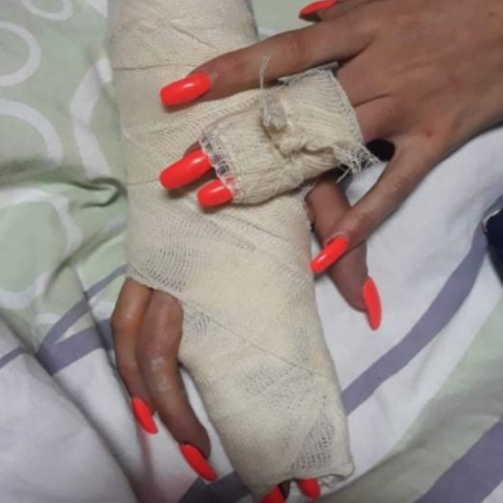 Nezapamćeno maltretiranje u Šidu! Ošišao joj kosu do glave, sekao kuhinjskim nožem i satima maltretirao...