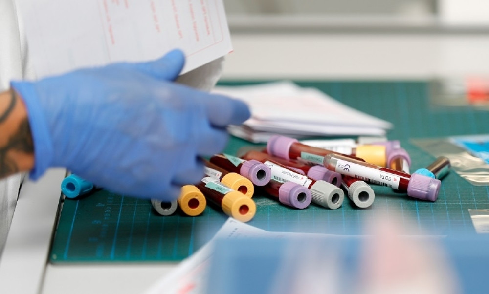 Od krvne grupe zavisi da li ćete završiti na respiratoru!