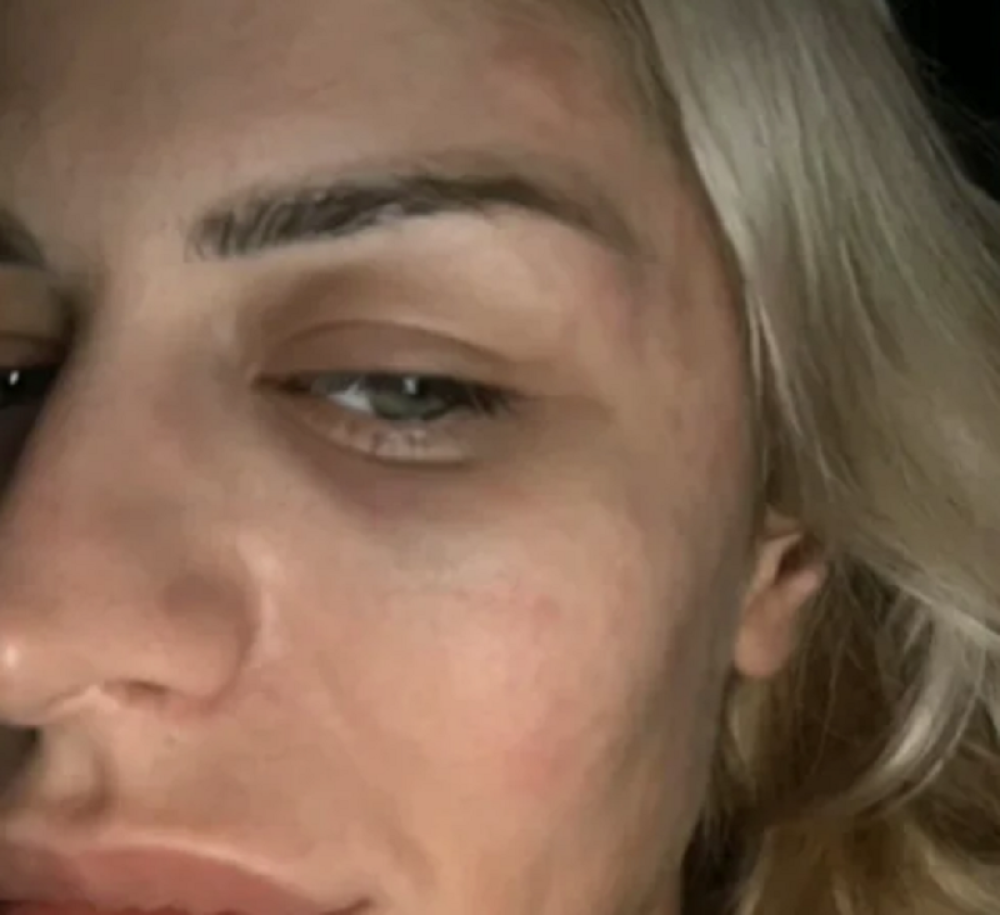 Sandra Obradović objavila snimak na kom dobija jezive batine bivšeg dečka (VIDEO)