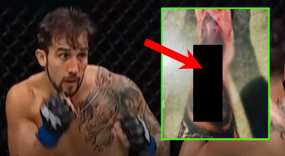 Podelio jezivu sliku krvave noge, a na njoj rupčina veća nego na asfaltu! (UZNEMIRUJUĆ FOTO/VIDEO)