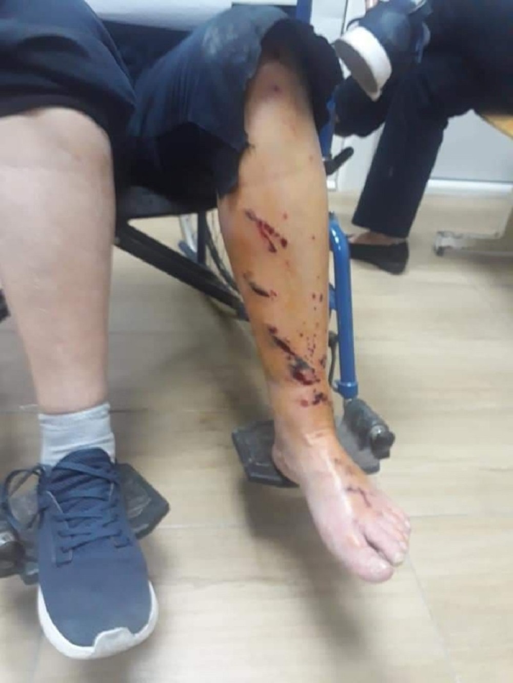 (UZNEMIRUJUĆI SADRŽAJ) Krvav prizor Milove samovolje, policija muškarcu odrala leđa, žena sa krvavom nogom i u kolicama