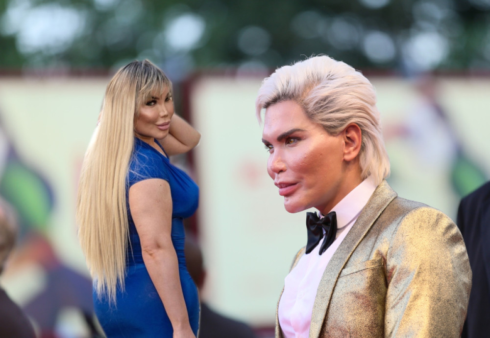 Ljudski Ken postao Barbika: Sudbina Rodrigu nije dala da bude muško! (FOTO)