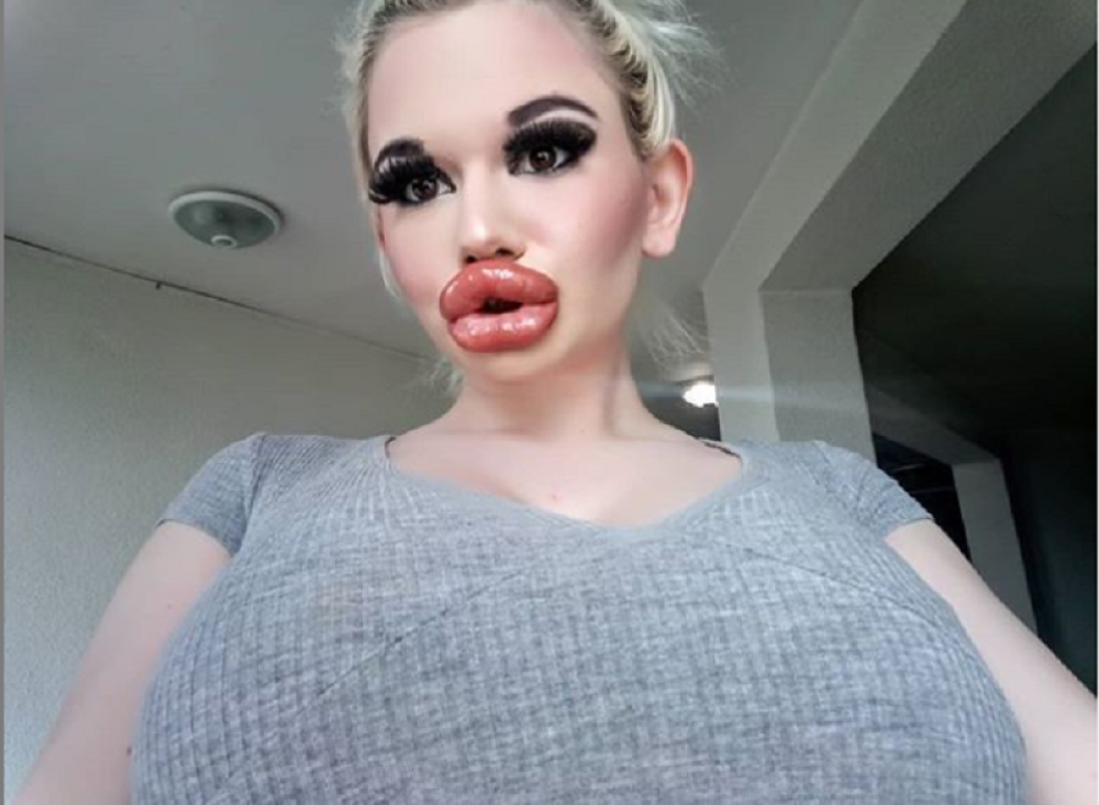 Išla pod nož čak 20 puta i ne namerava da stane (FOTO)