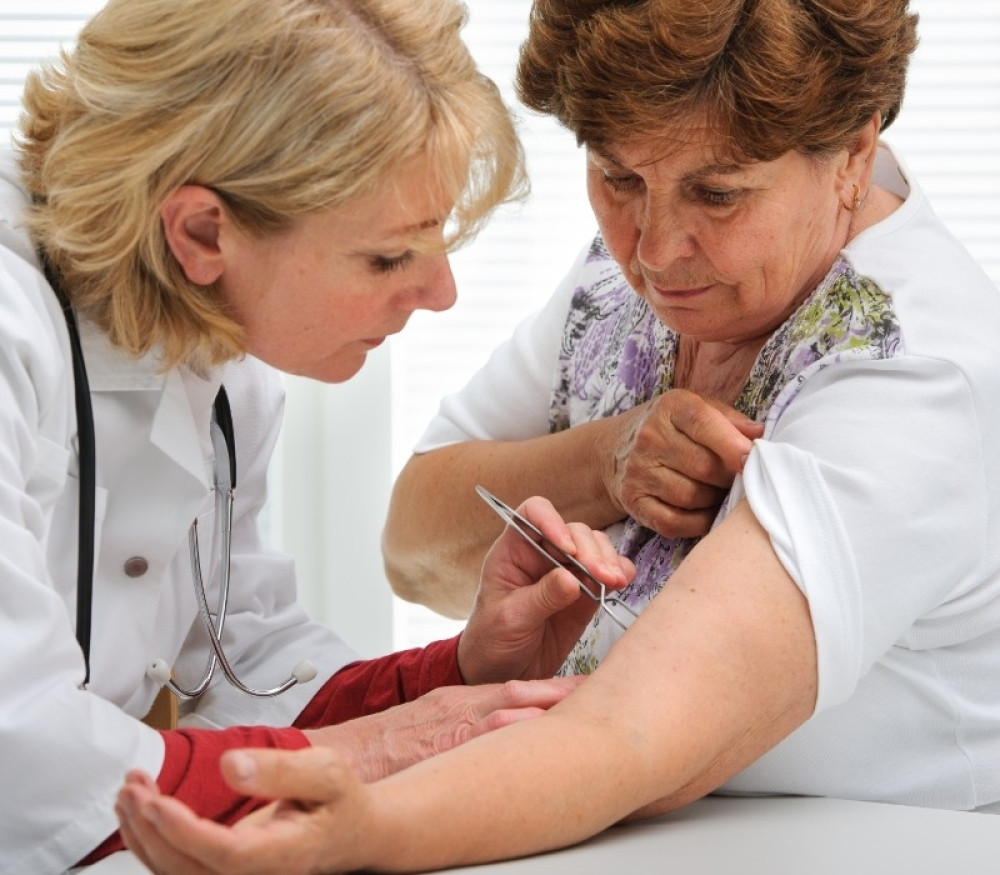 Krpelji izazivaju lajmsku bolest, a ovi simptomi se često javljaju