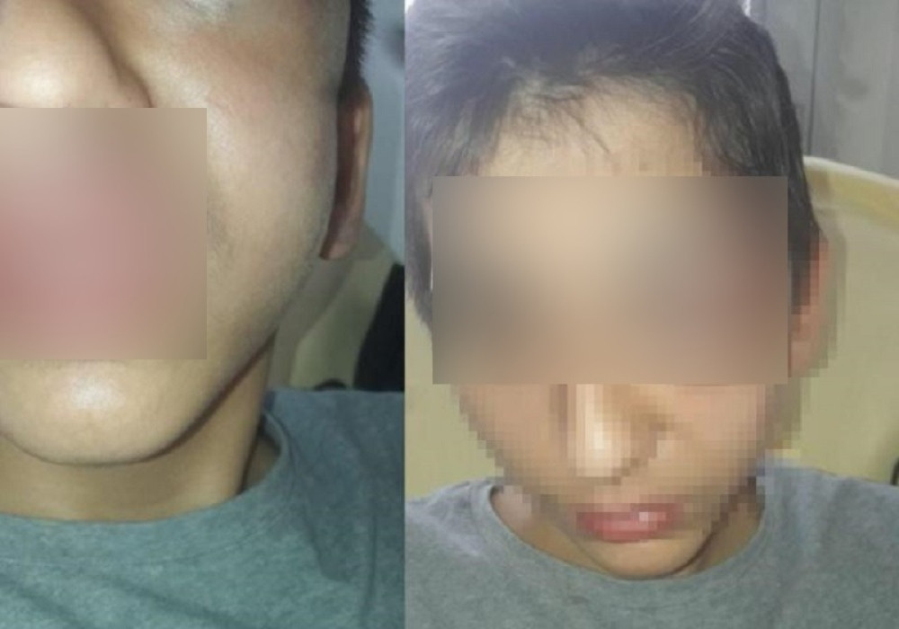 Dečaka (14) iz Srbije najbrutalnije pretukli u Parizu! (FOTO)